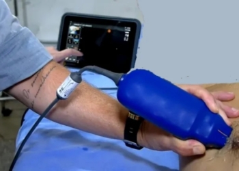 Foto: Arquivo Sesau / Secom / Governo de Rondônia