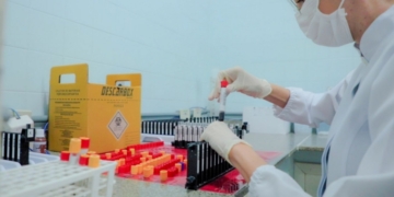 Mpox em Porto Velho - Foto: Secom